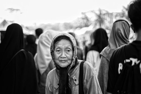 L'Importance Cruciale de la Pathologie Générale dans le Diagnostic du Cancer